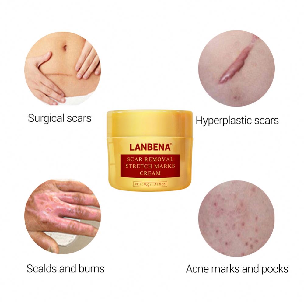 Crema Anti-Cicatrici LANBENA, Regenerator și Vindecător al Pielii, reduce Acneea, calmează Iritația, Hidratează