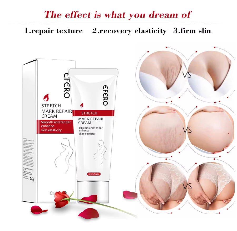 Crema EFERO pentru Vergeturi, Efect de Regenerare Celulara, Redare Elasticitate, Elaimei Stretch Mark