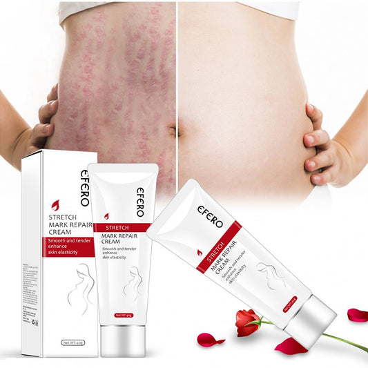 Crema EFERO pentru Vergeturi, Efect de Regenerare Celulara, Redare Elasticitate, Elaimei Stretch Mark